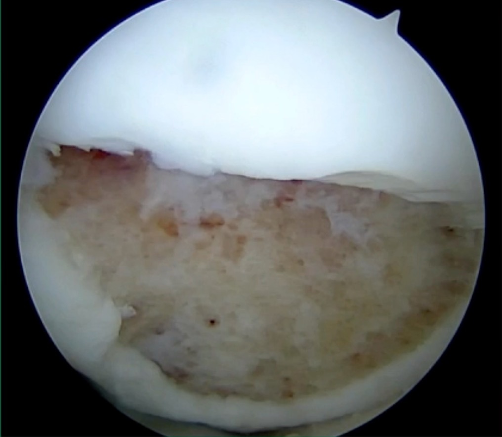 A white round object with a black background AI-generated content may be incorrect.