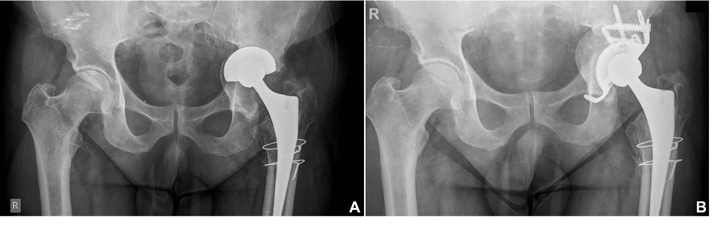 A close-up of x-ray images AI-generated content may be incorrect.