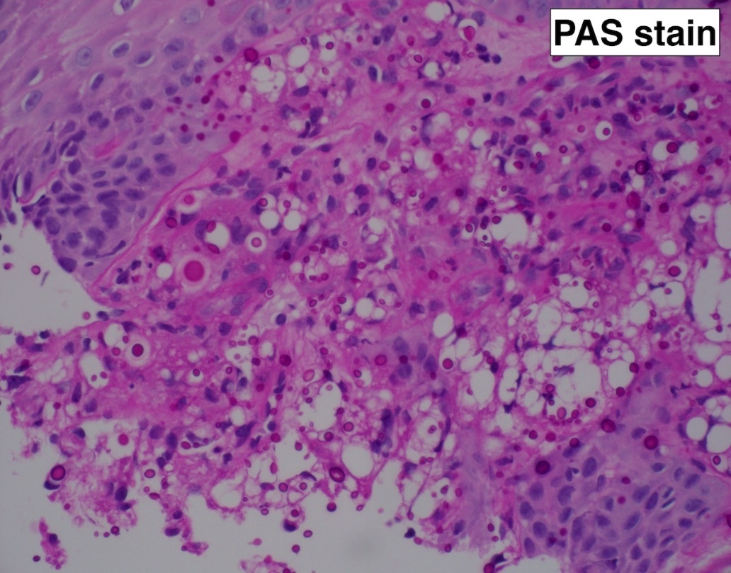 A close-up of a pink and white cell AI-generated content may be incorrect.