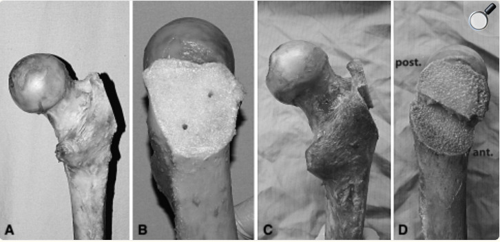 A close-up of a bone Description automatically generated