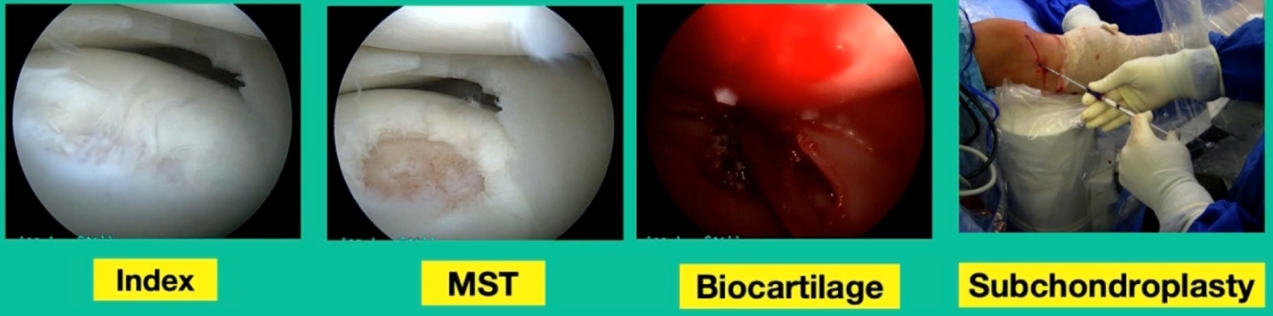 A collage of teeth AI-generated content may be incorrect.