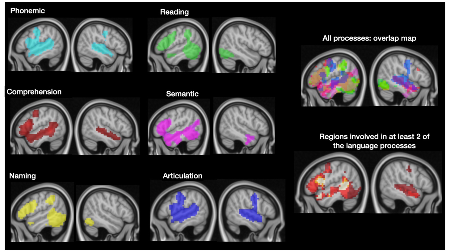 Consensus recommendations for clinical functional MRI applied to