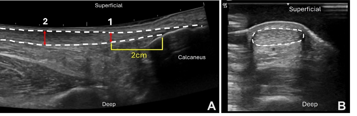 A close-up of ultrasound images AI-generated content may be incorrect.