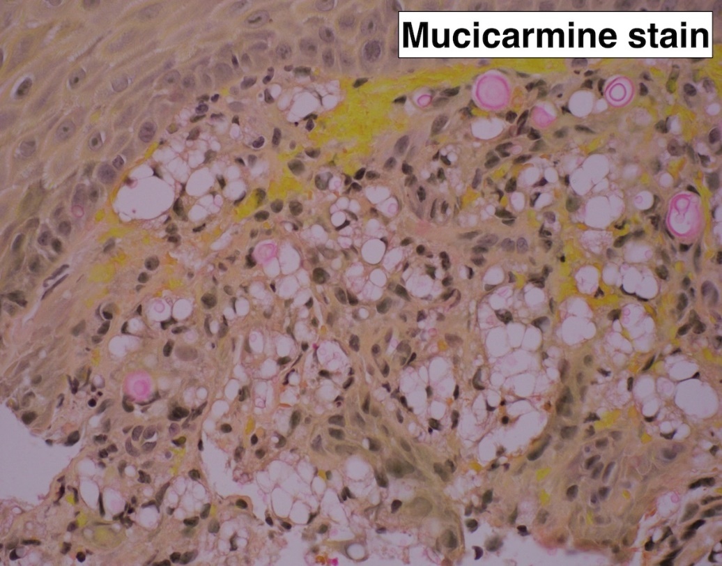 A microscope view of mucidarine cells AI-generated content may be incorrect.
