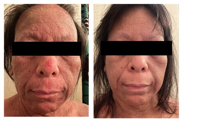 A collage of a person's face Description automatically generated
