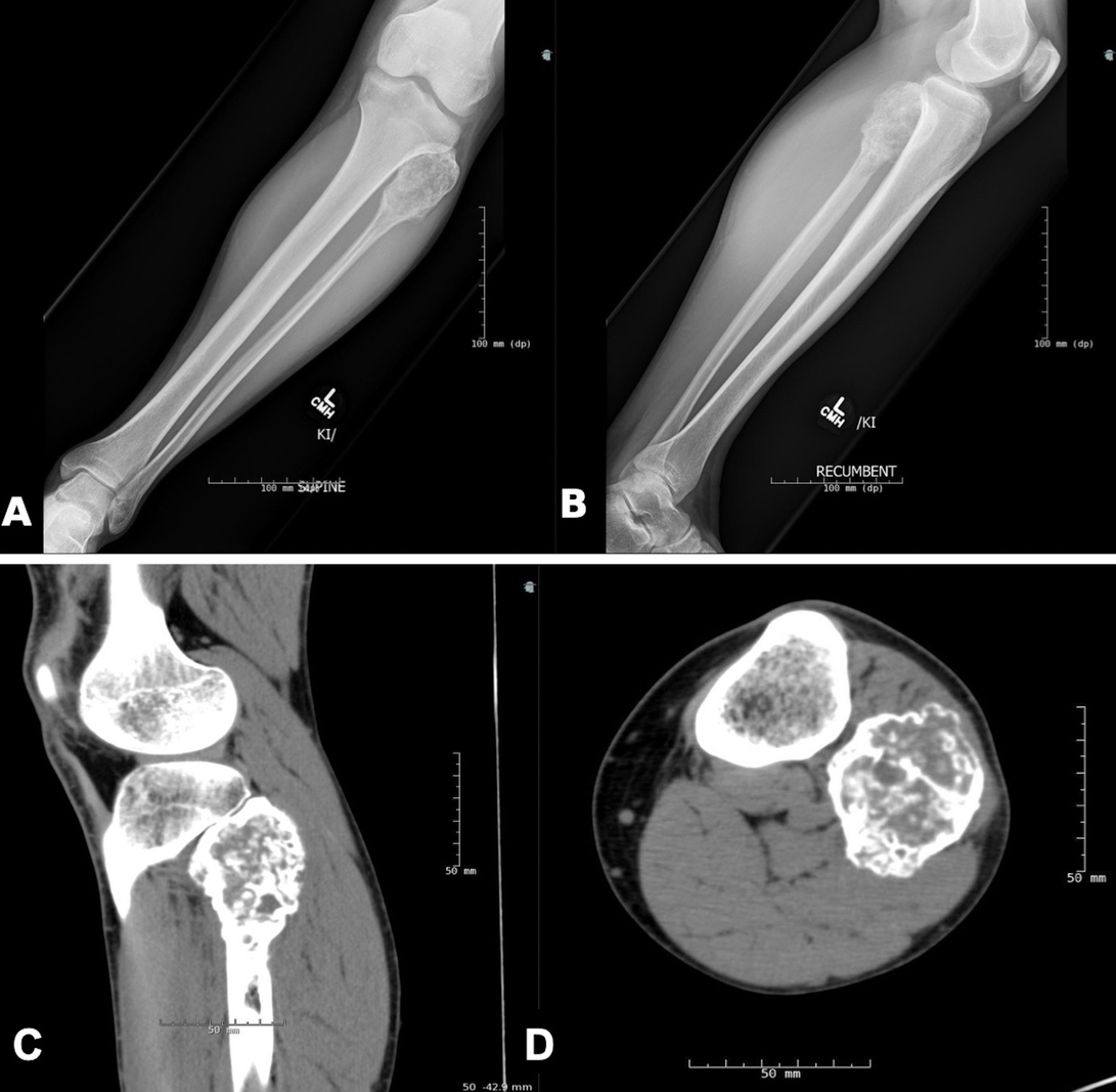 Tumor Construction of [89Zr]Zr-Labeled HuL13 for ImmunoPET Imaging