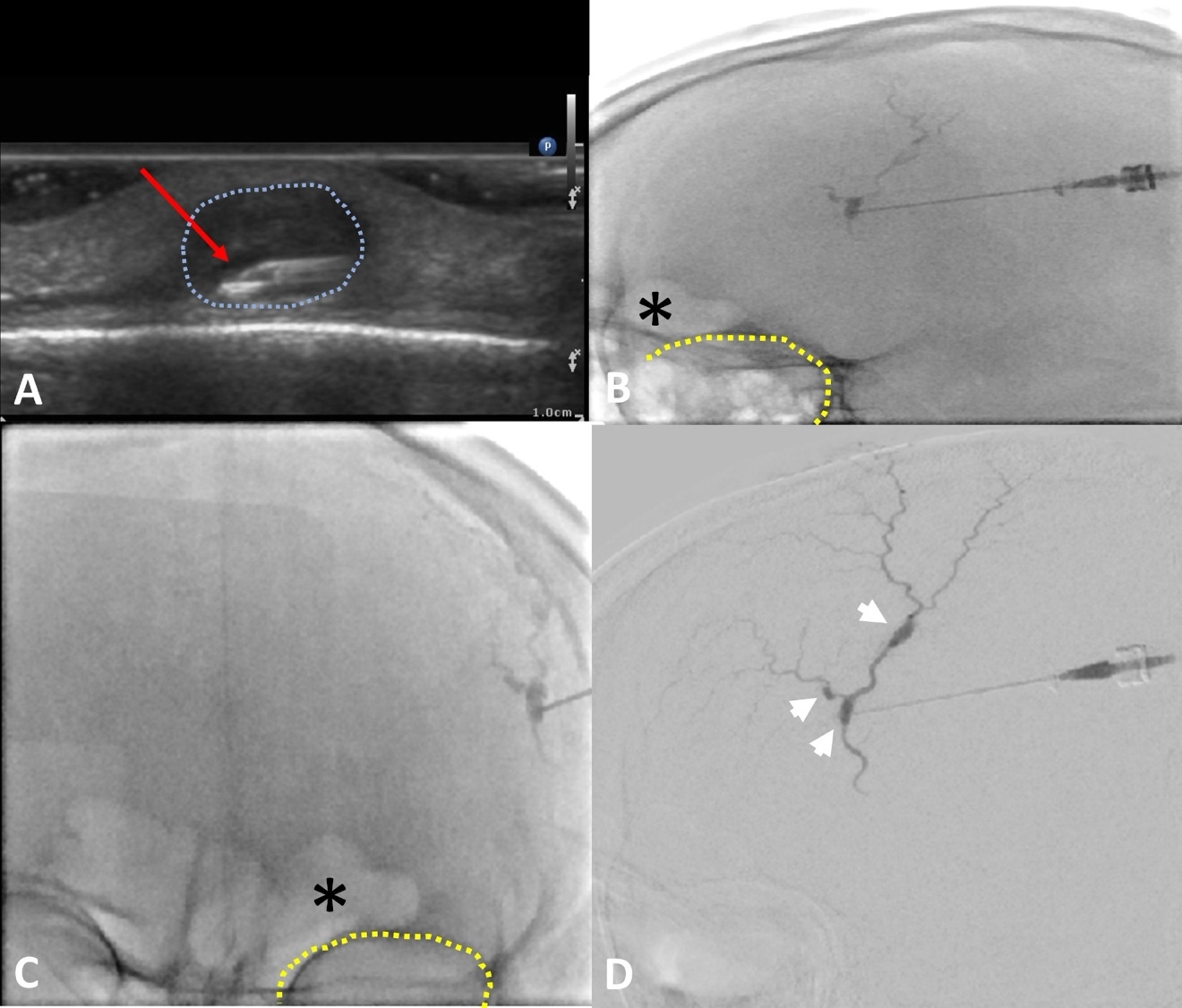 A close-up of a medical scan AI-generated content may be incorrect.