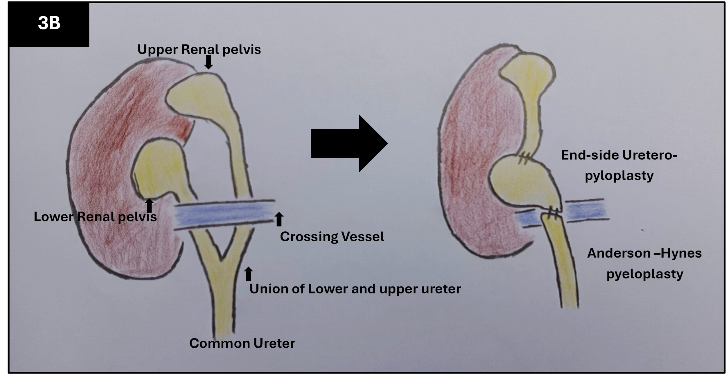 Figure 3b