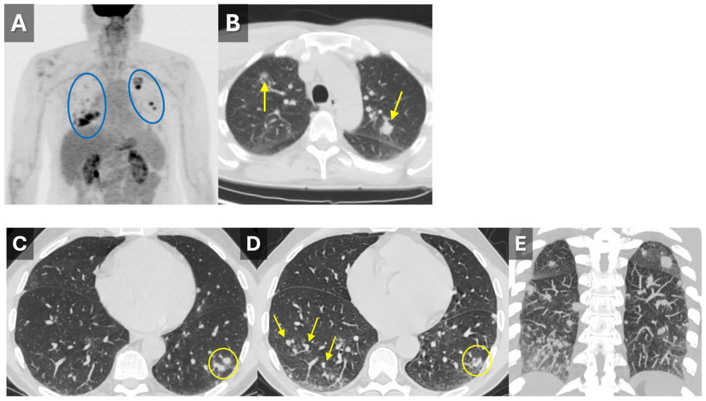 A close-up of a chest x-ray AI-generated content may be incorrect.