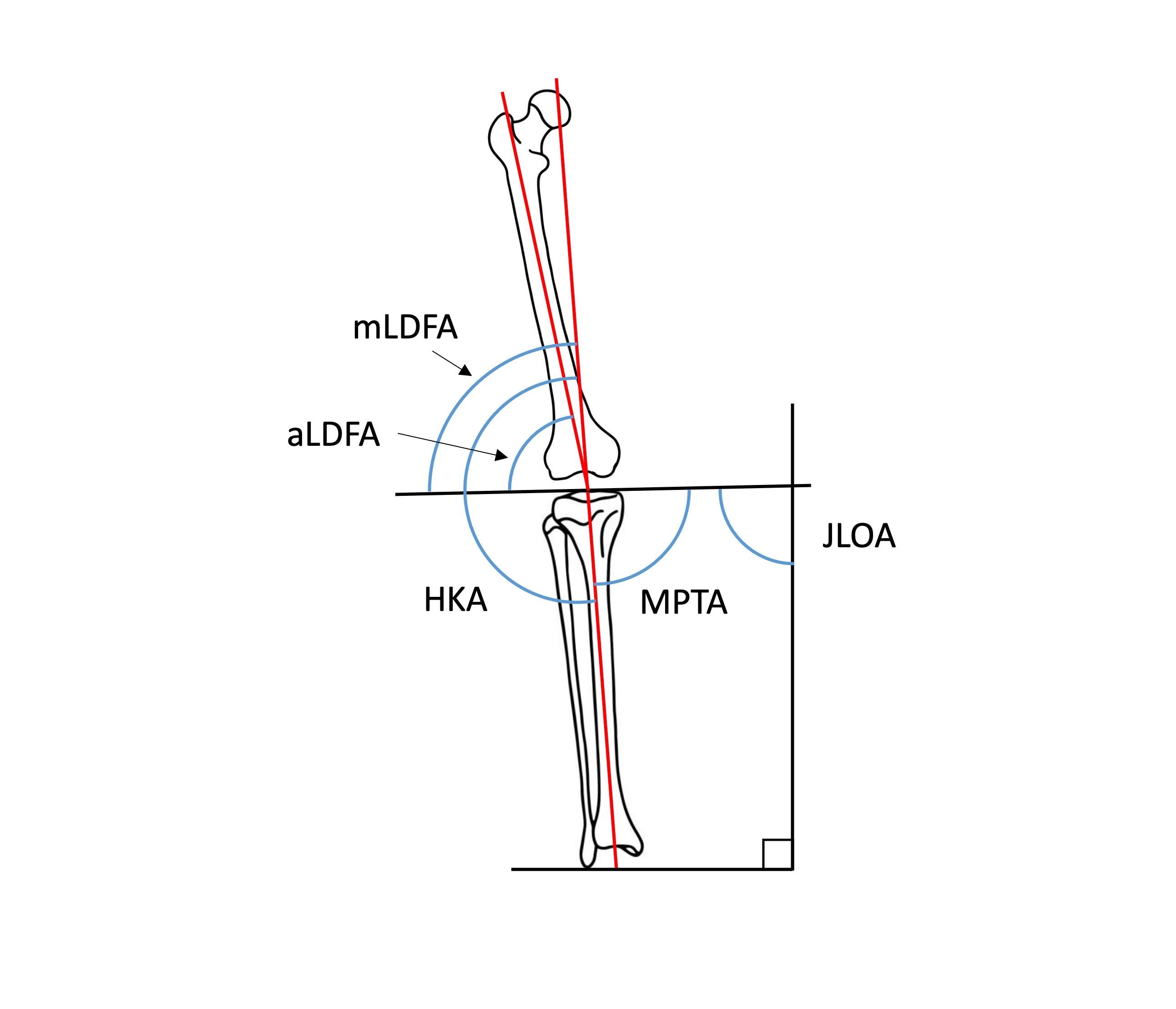 3本セット Methods of alignment in total knee arthroplasty, systematic review