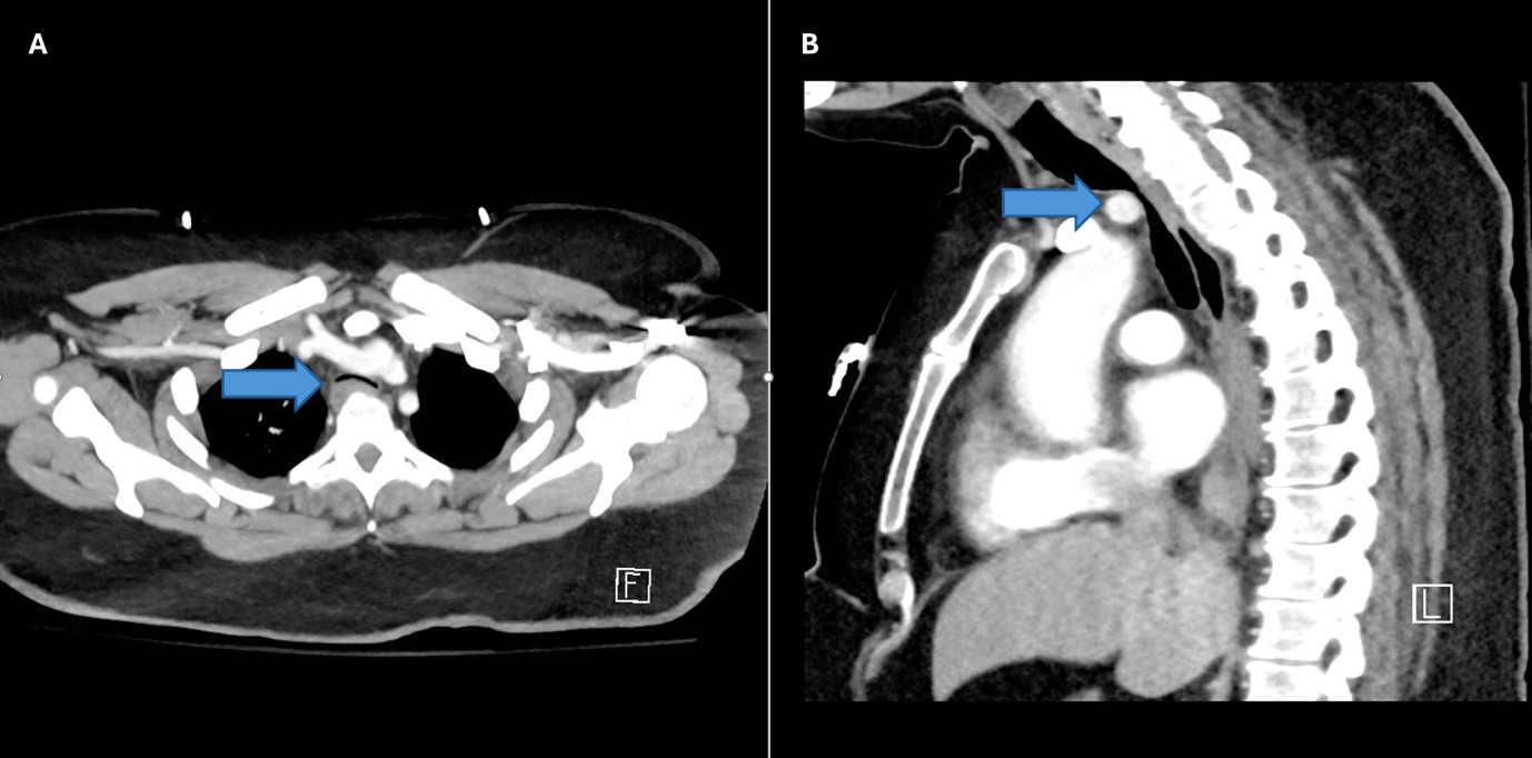 A close-up of a scan of a chest Description automatically generated