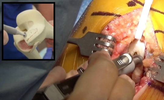 A close-up of a person's hand AI-generated content may be incorrect.