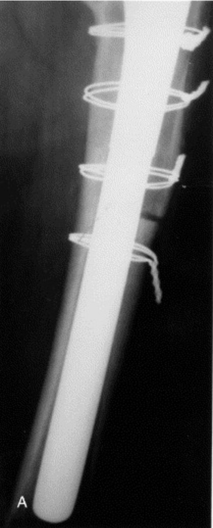 A close-up of a light Description automatically generated