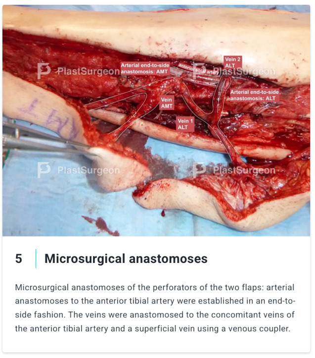 Et billede, der indeholder tekst, Fastfood, Kød/hud, mad Automatisk genereret beskrivelse