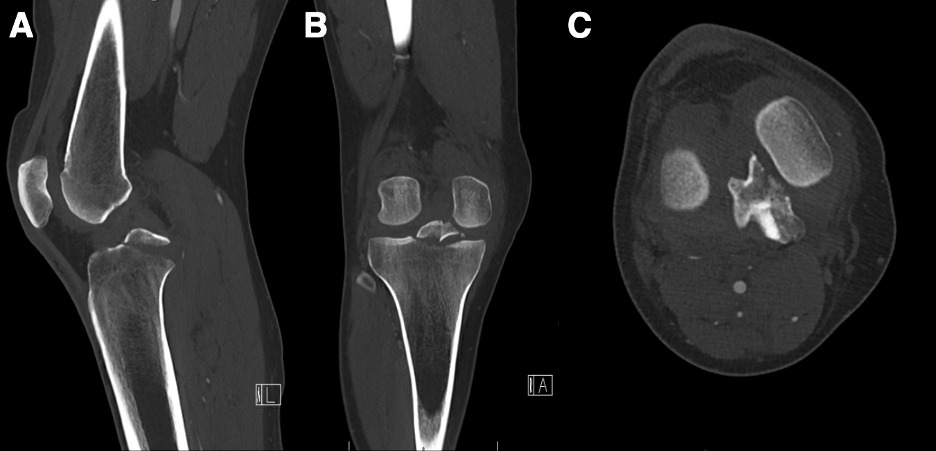 A close-up of x-ray images Description automatically generated
