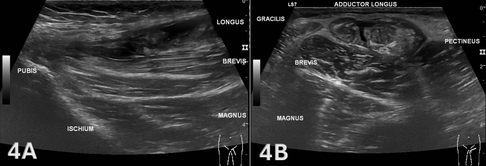 A ultrasound of a baby AI-generated content may be incorrect.