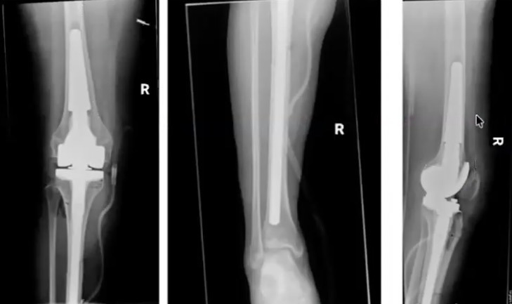 Figure 16