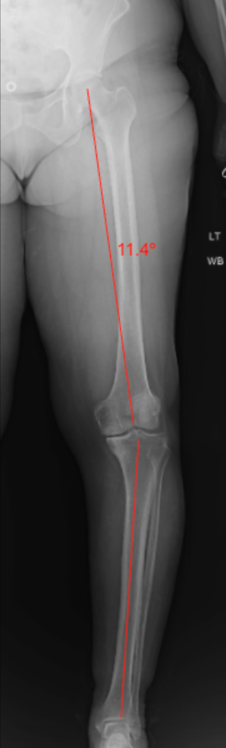 膝を診る目 - The Knee Up Close figure_1.