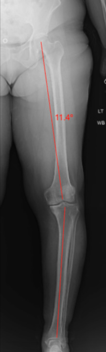 figure_1.