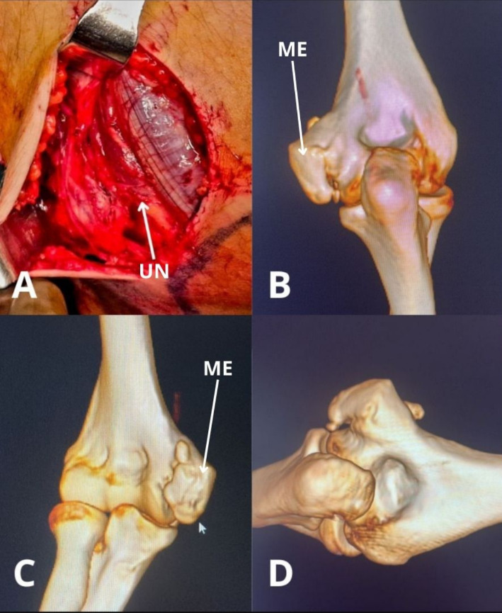 A close-up of bones AI-generated content may be incorrect.