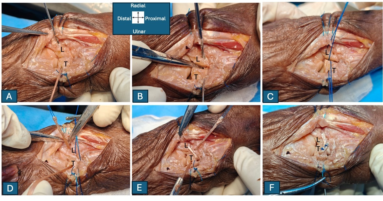 Close-up of a human arm AI-generated content may be incorrect.