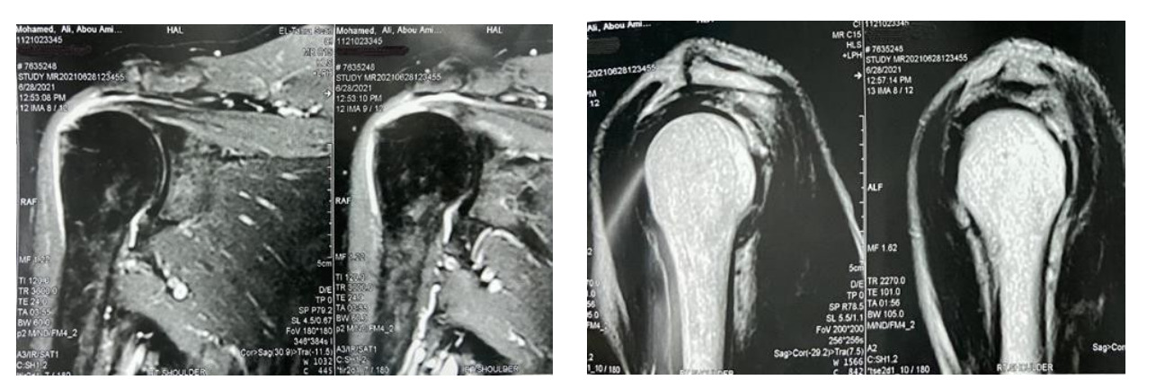 Figure 3A