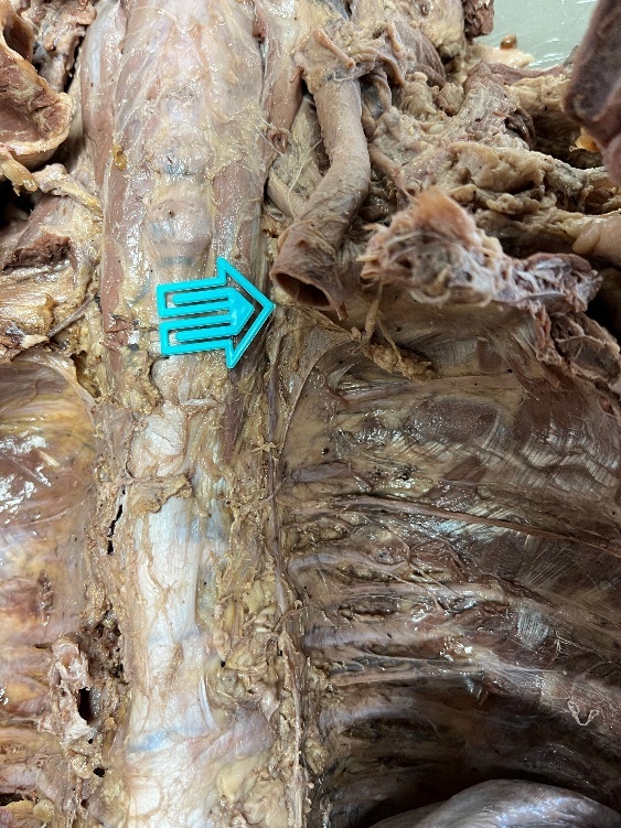 A blue arrow on a piece of meat AI-generated content may be incorrect.