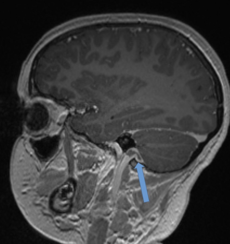 A mri of a brain AI-generated content may be incorrect.