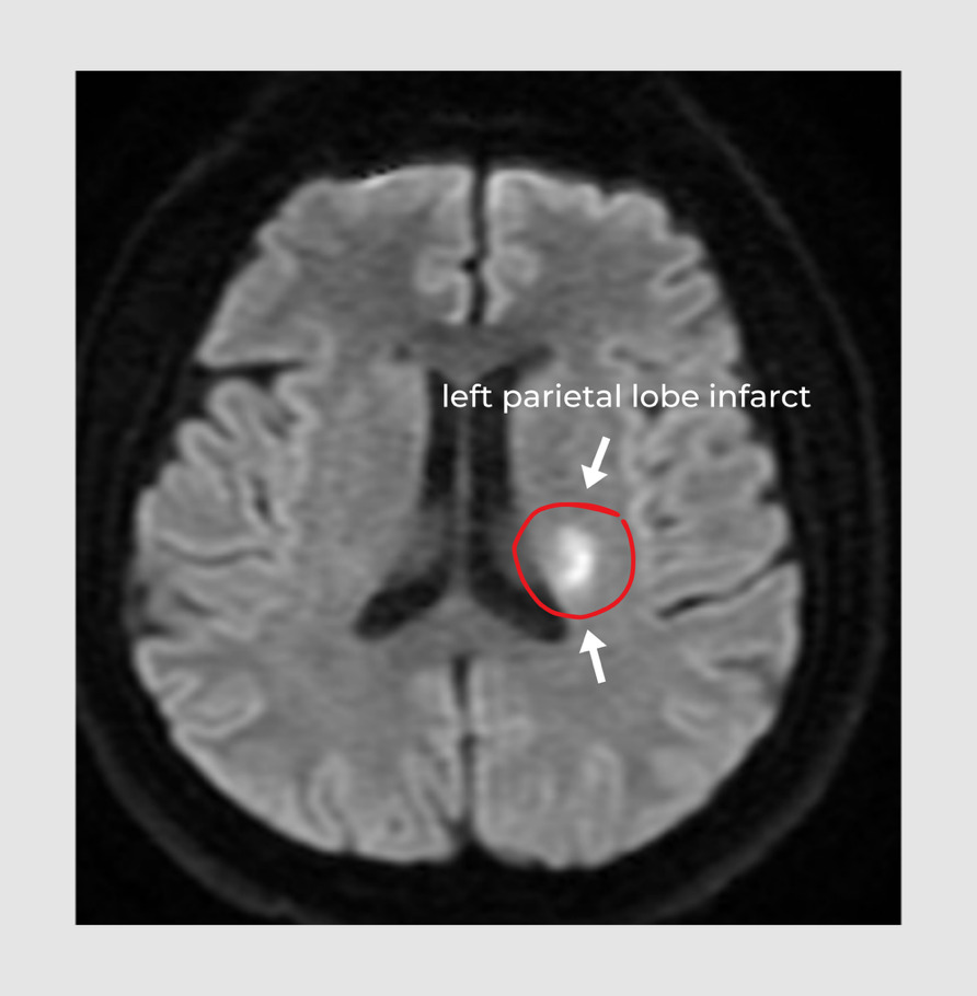 A close-up of a brain scan AI-generated content may be incorrect.
