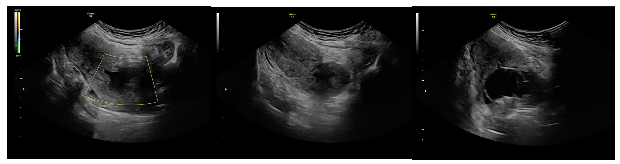 A ultrasound image of a baby AI-generated content may be incorrect.