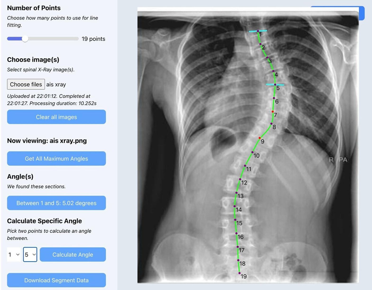 A screenshot of a x-ray of a human body AI-generated content may be incorrect.