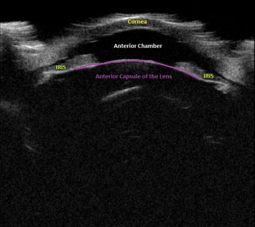 An ultrasound of the fetus AI-generated content may be incorrect.