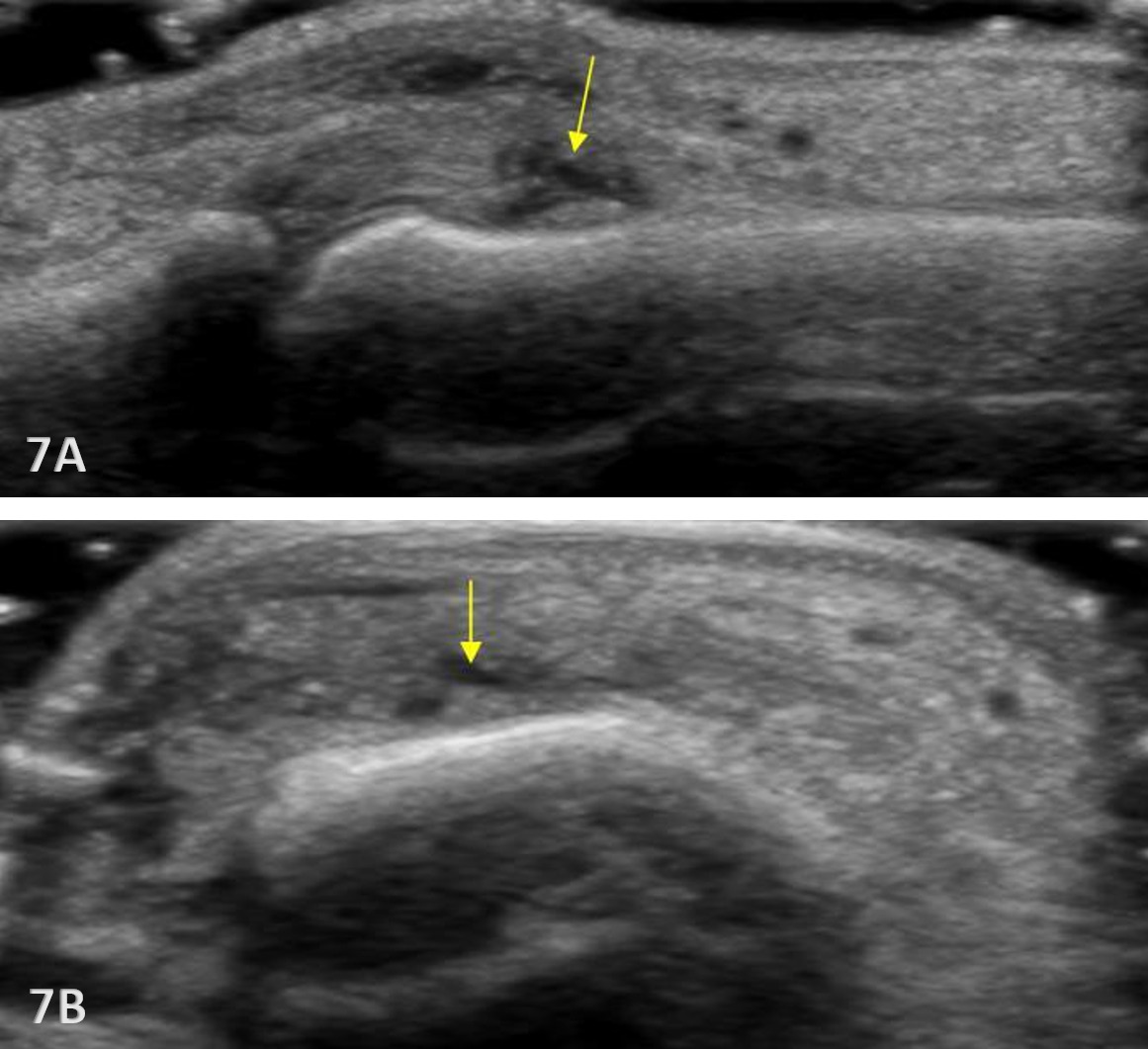 Ultrasound of a fetus AI-generated content may be incorrect.