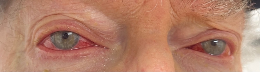 A close up of a person's face Description automatically generated