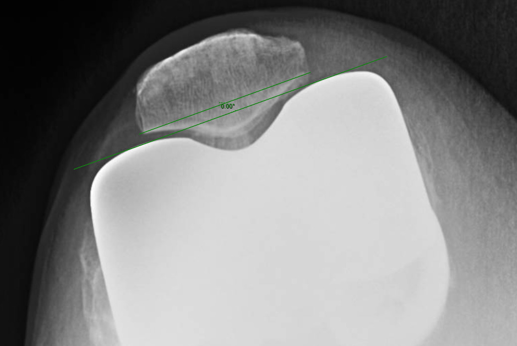 A white plate with a green leaf on it Description automatically generated with medium confidence