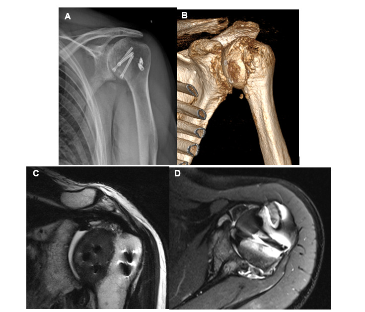 Figure 15