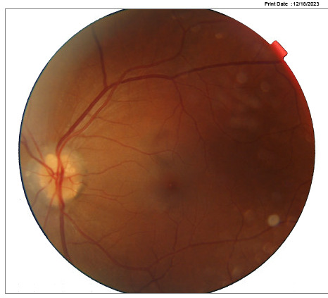 A close-up of a red blood vessels Description automatically generated
