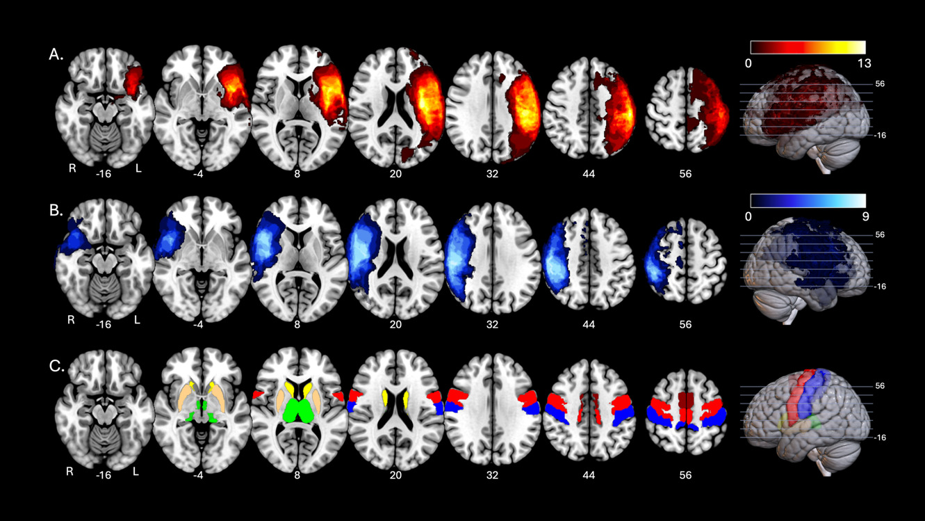 A group of brain images AI-generated content may be incorrect.