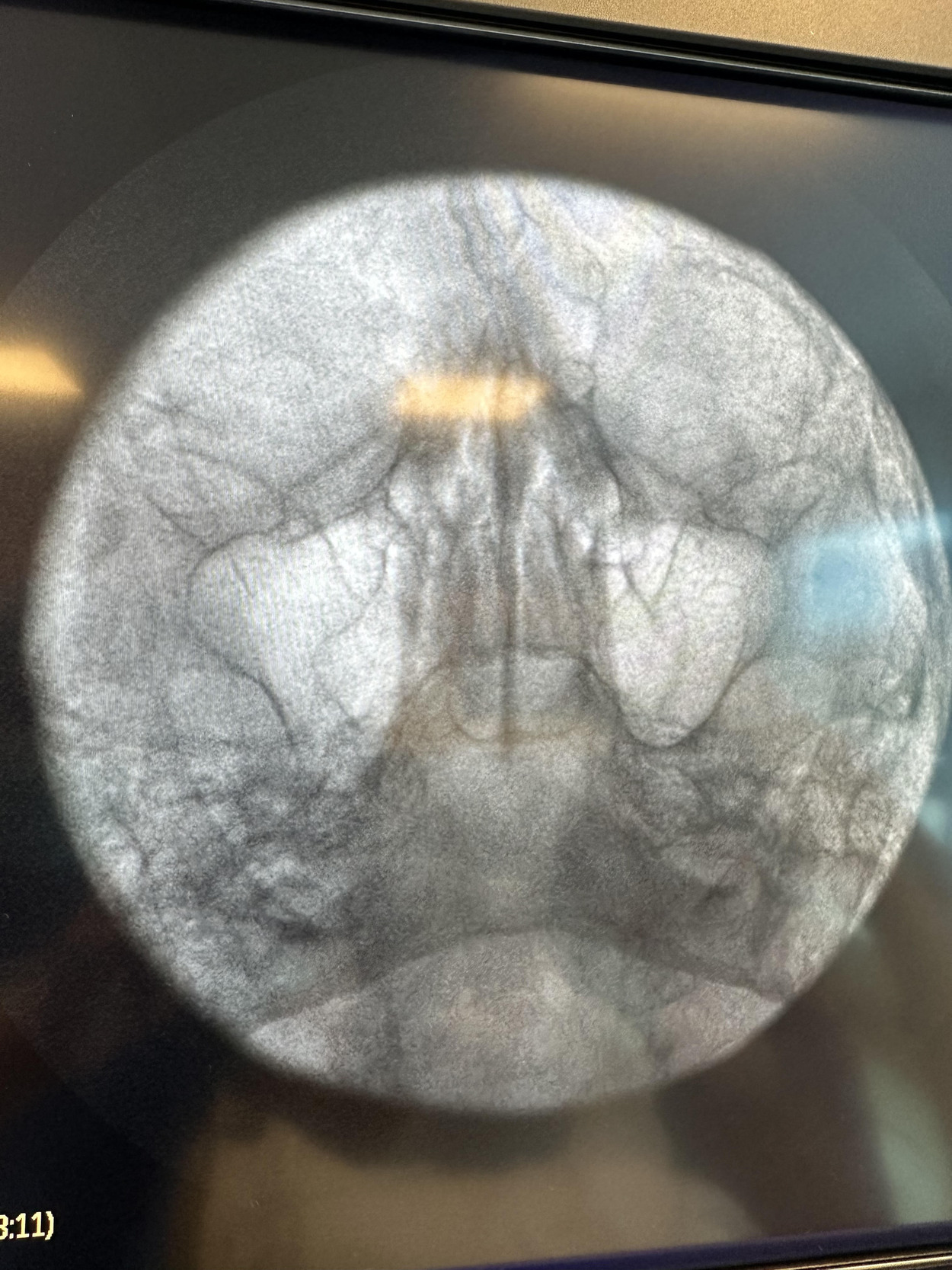 A close-up of a circular object AI-generated content may be incorrect.