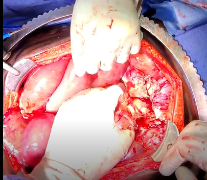 A person's hands holding a heart AI-generated content may be incorrect.