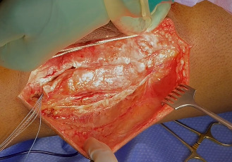 A person performing surgery on a patient AI-generated content may be incorrect.