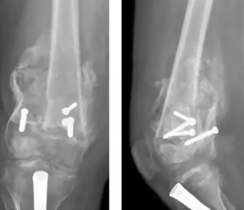 Figure 13