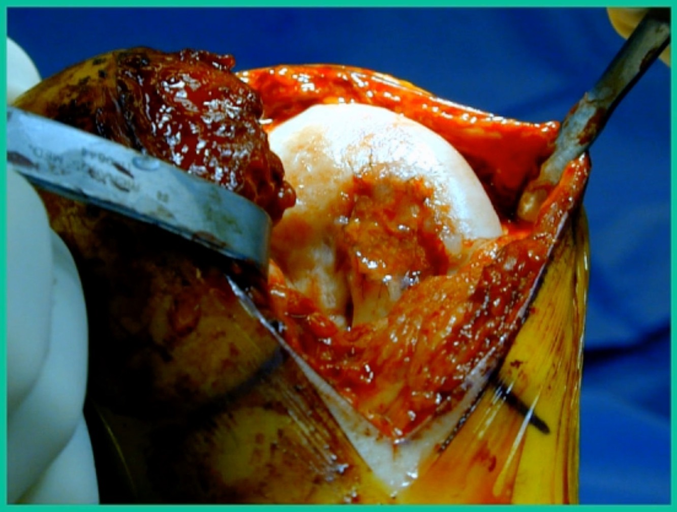 Close-up of a banana peel with a knife AI-generated content may be incorrect.