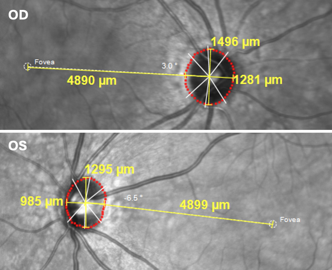 A comparison of a microscope image Description automatically generated with medium confidence