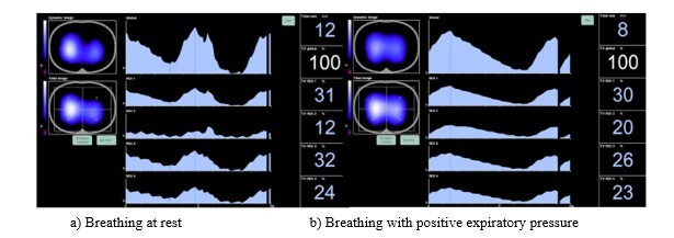 A screenshot of a computer screen AI-generated content may be incorrect.