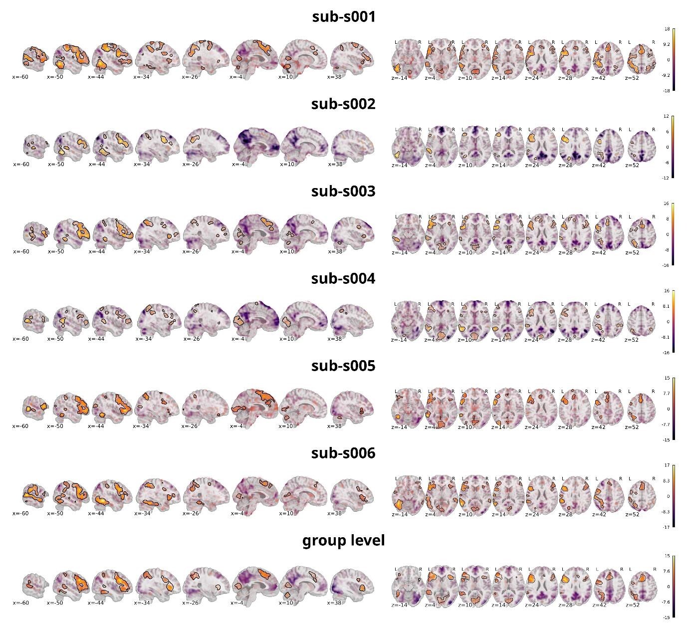A row of brain images AI-generated content may be incorrect.