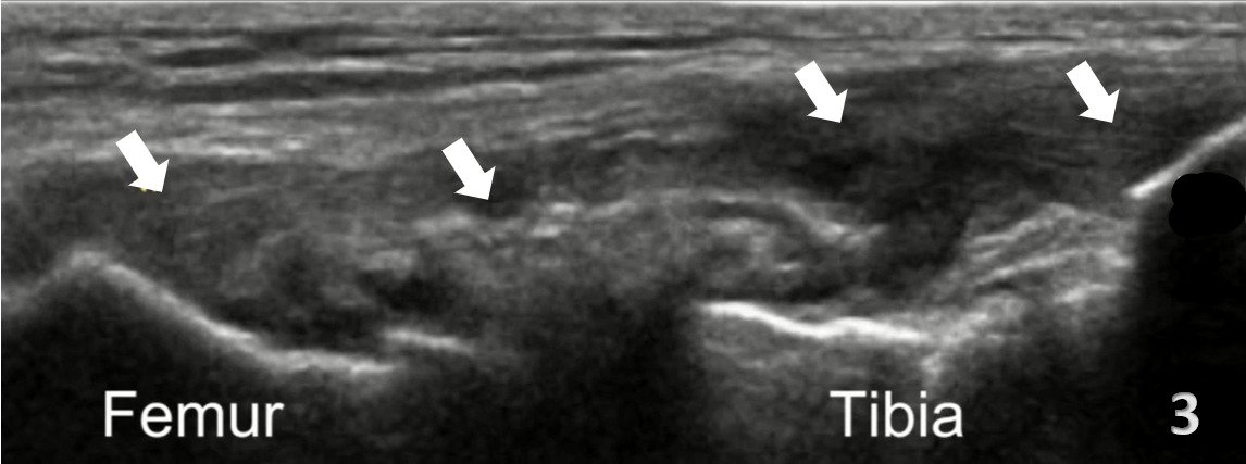 An ultrasound of a fetus AI-generated content may be incorrect.