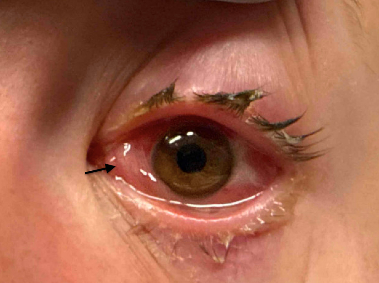 A close up of an eye AI-generated content may be incorrect.