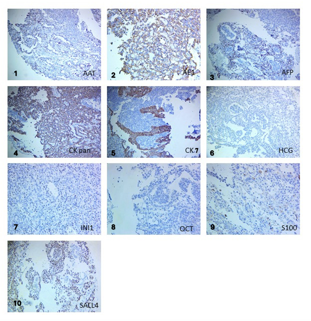 A collage of images of cells AI-generated content may be incorrect.