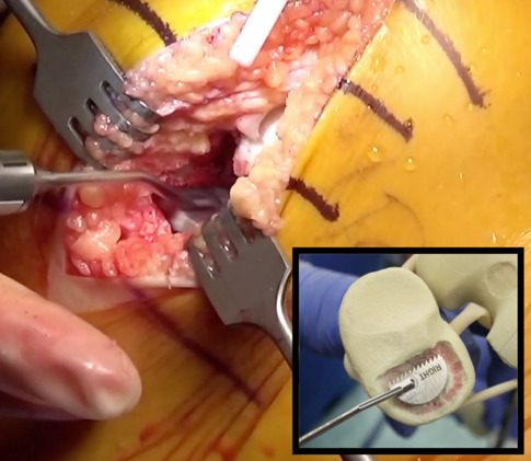 A close-up of a person's body AI-generated content may be incorrect.